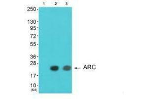 Western blot analysis of extracts from HeLa cells and A549 cells using ARC antibody. (ARC 抗体)