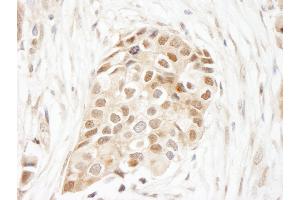 Immunohistochemistry (IHC) image for anti-Ubiquitin (Ub) (AA 1-50) antibody (ABIN7448849)