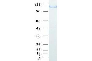 Western Blotting (WB) image for L1 Cell Adhesion Molecule (L1CAM) (Transcript Variant 1) protein (Myc-DYKDDDDK Tag) (ABIN2713465)