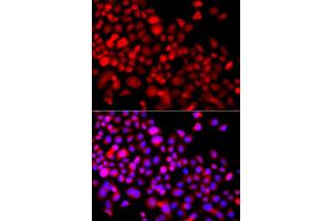 Immunofluorescence analysis of A549 cells using CALCOCO1 antibody (ABIN5975736). (CALCOCO1 抗体)