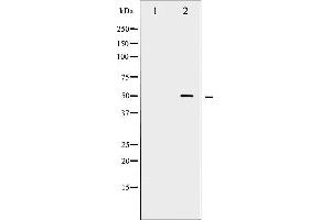 Western blot analysis of Myc phosphorylation expression in Forskolin treated 293 whole cell lysates,The lane on the left is treated with the antigen-specific peptide. (c-MYC 抗体  (pSer62))