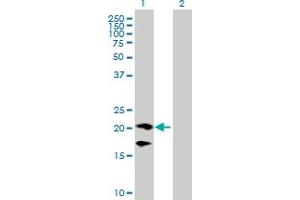 Western Blot analysis of CD160 expression in transfected 293T cell line by CD160 MaxPab polyclonal antibody. (CD160 抗体  (AA 1-181))