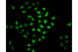 Immunofluorescence staining of Hela cells with ABIN7145662 at 1:66, counter-stained with DAPI. (BOLA2 抗体  (AA 1-86))