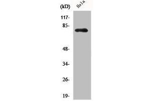 Western Blot analysis of HELA cells using Phospho-Btk (Y551) Polyclonal Antibody (BTK 抗体  (pTyr551))