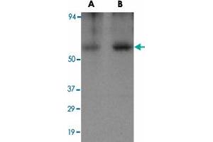 Western blot analysis of CLU in human brain tissue lysate with CLU polyclonal antibody  at (A) 0. (Clusterin 抗体)