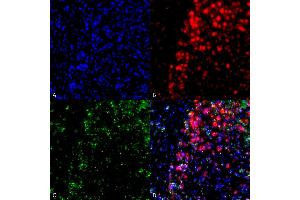 Immunocytochemistry/Immunofluorescence analysis using Mouse Anti-Alpha Synuclein Monoclonal Antibody, Clone 3F8 (ABIN5564104). (SNCA 抗体  (PerCP))
