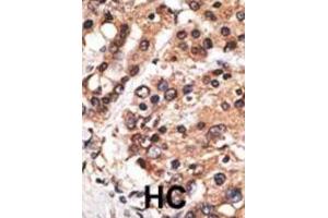 Immunohistochemistry (IHC) image for anti-Protein AF-9 (MLLT3) antibody (ABIN2971008) (AF9 抗体)