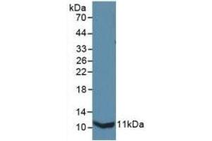 Detection of Recombinant IL13Ra2, Mouse using Polyclonal Antibody to Interleukin 13 Receptor Alpha 2 (IL13Ra2) (IL13RA2 抗体  (AA 228-338))