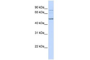 WB Suggested Anti-ALS2CR12 Antibody Titration: 0. (ALS2CR12 抗体  (N-Term))