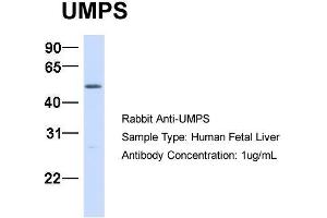 Western Blotting (WB) image for anti-Uridine Monophosphate Synthetase (UMPS) (C-Term) antibody (ABIN2783243)
