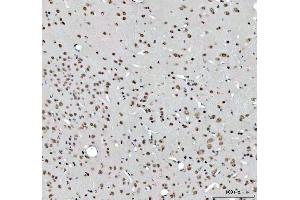 IHC analysis of RTCB using anti-RTCB antibody (ABIN7600722).