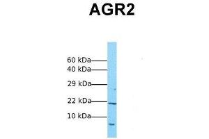 Host:  Rabbit  Target Name:  AGR2  Sample Tissue:  Human MCF7  Antibody Dilution:  1. (AGR2 抗体  (Middle Region))