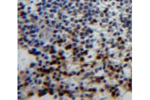 #VALUE! (T-Bet 抗体  (AA 160-399))