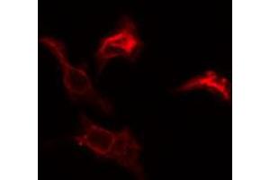 ABIN6274782 staining COLO205 cells by IF/ICC. (RPL39 抗体  (C-Term))