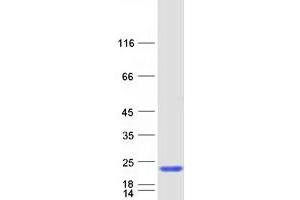 Western Blotting (WB) image for Sin3A-Associated Protein, 18kDa (SAP18) protein (Myc-DYKDDDDK Tag) (ABIN2731387)