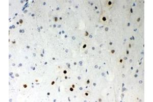 IHC testing of FFPE rat brain with SF2 antibody. (SRSF1 抗体)