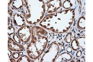 Immunohistochemical staining of paraffin-embedded liver tissue using anti-IFIT1 mouse monoclonal antibody. (IFIT1 抗体)