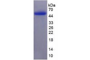 SDS-PAGE analysis of Human vWFCP Protein. (ADAMTS13 蛋白)