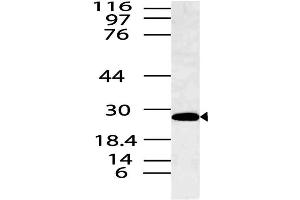 Image no. 1 for anti-Spi-B Transcription Factor (Spi-1/PU.1 Related) (SPIB) antibody (ABIN5027786)