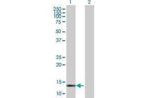 Western Blot analysis of CRABP2 expression in transfected 293T cell line by CRABP2 MaxPab polyclonal antibody. (CRABP2 抗体  (AA 1-138))