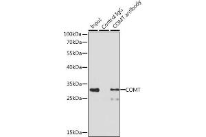 Immunoprecipitation analysis of 200 μg extracts of MCF-7 cells, using 3 μg COMT antibody (ABIN1679321, ABIN3015439, ABIN3015440 and ABIN6216759). (COMT 抗体  (AA 42-221))