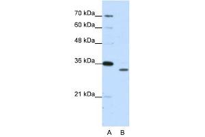 Western Blotting (WB) image for anti-Proteasome Subunit alpha Type 1 (PSMA1) antibody (ABIN629944)