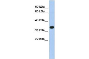 WB Suggested Anti-SULT1B1 Antibody Titration:  0. (SULT1B1 抗体  (N-Term))