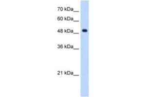 Western Blotting (WB) image for anti-Septin 6 (SEPT6) antibody (ABIN2462958) (Septin 6 抗体)