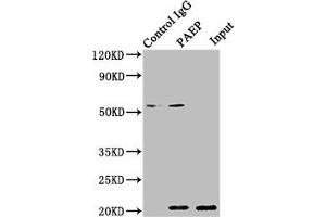 Immunoprecipitating PAEP in 293T whole cell lysate Lane 1: Rabbit control IgG instead of ABIN7154198 in 293T whole cell lysate. (PAEP 抗体  (AA 19-180))