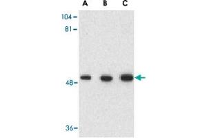Western blot analysis of GOPC in rat colon cell lysate with GOPC polyclonal antibody  at (A) 1, (B) 2 and (C) 4 ug/mL .