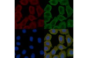 ABIN6258508 and ABIN6274718 staining Hela cells(30 min of UV treatment) by IF/ICC.