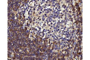 Immunohistochemistry analysis of paraffin-embedded human tonsil using c-Kit Polyclonal Antibody at dilution of 1:200. (KIT 抗体)