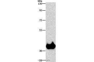 Western blot analysis of Mouse brain tissue, using ASPA Polyclonal Antibody at dilution of 1:1150 (ASPA 抗体)