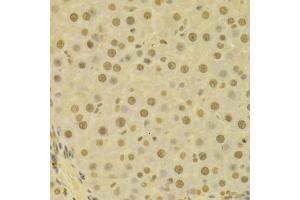 Immunohistochemistry of paraffin-embedded human liver using COPS5 antibody (ABIN5970887) at dilution of 1/100 (40x lens). (COPS5 抗体)