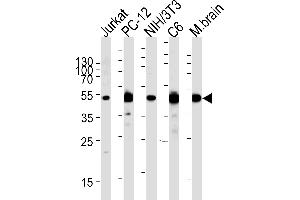 Western blot analysis of lysates from Jurkat,rat PC-12,mouse NIH/3T3,rat C6 cell line and mouse brain tissue (from left to right),using P2K1 Antibody (P1) (ABIN1882101 and ABIN2842058). (MEK1 抗体  (N-Term))