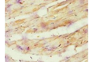 Immunohistochemistry (IHC) image for anti-ATP Synthase, H+ Transporting, Mitochondrial F1 Complex, O Subunit (ATP5O) (AA 24-213) antibody (ABIN7144869)