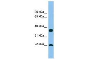 Image no. 1 for anti-WAP Four-Disulfide Core Domain 1 (WFDC1) (C-Term) antibody (ABIN6745156) (WFDC1 抗体  (C-Term))
