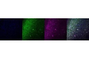 Immunohistochemistry (IHC) image for anti-Calbindin (CALB1) antibody (ABIN7456075) (CALB1 抗体)