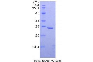 SDS-PAGE (SDS) image for Osteoclast Stimulating Factor 1 (OSTF1) (AA 12-214) protein (His tag) (ABIN1877695)