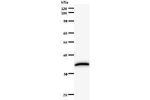 Western Blotting (WB) image for anti-RAR-Related Orphan Receptor C (RORC) antibody (ABIN932197)