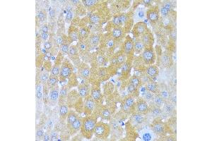 Immunohistochemistry of paraffin-embedded mouse liver using AARS antibody (ABIN7265526) at dilution of 1:100 (40x lens). (AARS 抗体  (AA 1-100))