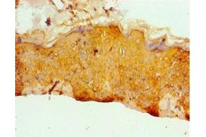 Immunohistochemistry of paraffin-embedded human skin tissue using ABIN7171955 at dilution of 1:100 (ERCC2 抗体  (AA 1-300))