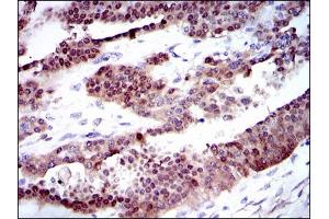 Immunohistochemistry (IHC) image for anti-Cytochrome P450, Family 1, Subfamily A, Polypeptide 1 (CYP1A1) antibody (ABIN1106884)