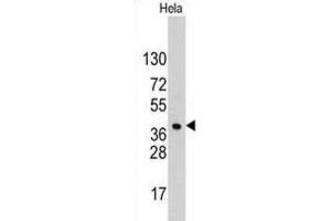 Western Blotting (WB) image for anti-Hepatoma-Derived Growth Factor (HDGF) antibody (ABIN3002632)