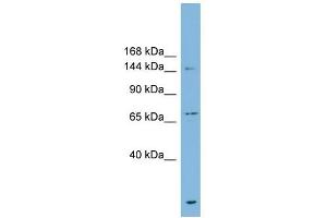 ABCB1 antibody used at 1 ug/ml to detect target protein. (ABCB1 抗体)