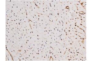 ABIN6267354 at 1/200 staining Mouse heart tissue sections by IHC-P. (MAPT 抗体  (pSer235))