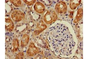 Immunohistochemistry of paraffin-embedded human kidney tissue using ABIN7149804 at dilution of 1:100 (DDA1 抗体  (AA 1-102))