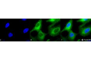 Immunocytochemistry/Immunofluorescence analysis using Rabbit Anti-Hsp90 Polyclonal Antibody . (HSP90 抗体  (PE))