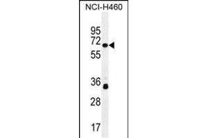 ZN Antibody (N-term) (ABIN655452 and ABIN2844980) western blot analysis in NCI- cell line lysates (35 μg/lane). (ZNF433 抗体  (N-Term))