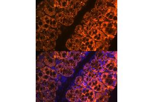 Immunofluorescence analysis of mouse large intestine using Galectin 4/LG Rabbit mAb (ABIN1679347, ABIN3017979, ABIN3017980 and ABIN7101554) at dilution of 1:100 (40x lens). (GAL4 抗体)